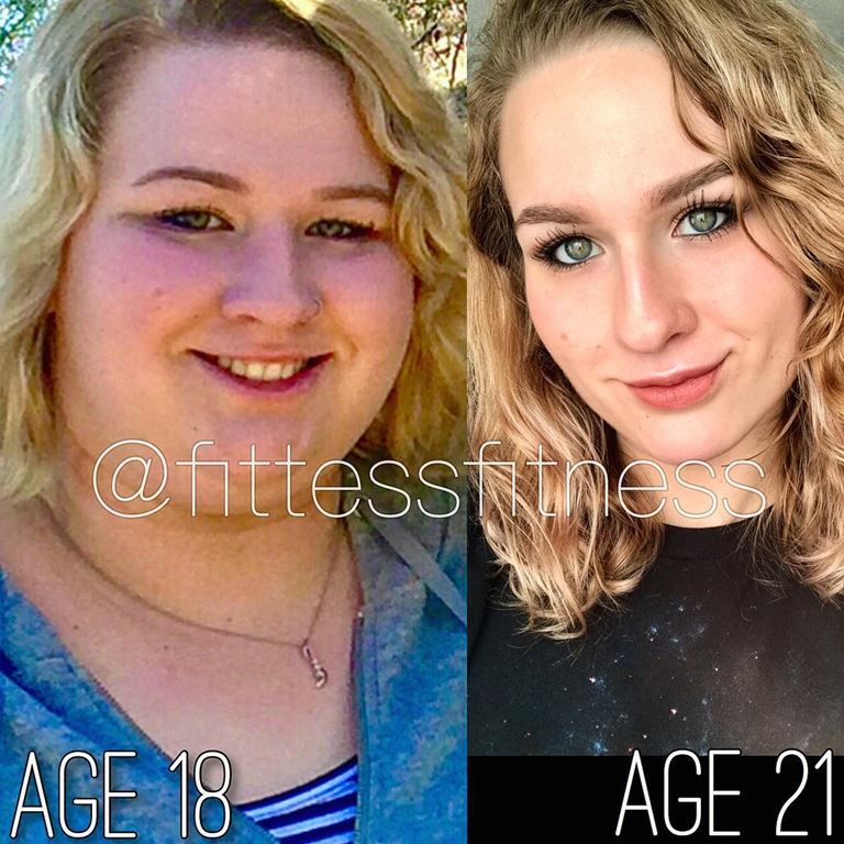 5 девушек, которые похудели на 30-100 кг - Тэсс Фитцжеральд – похудела на 100 кг - лицо до и после