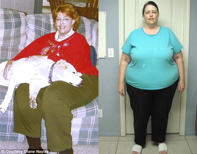Как в 60 лет похудеть на 102 килограмма и изменить свою жизнь - фото Дианы Нейлор