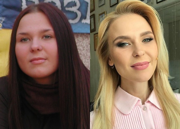 Жиру нет (а щеки долой): лица российских звёзд после похудения - Пелагея