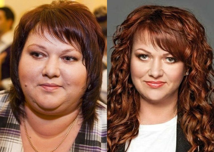 Жиру нет (а щеки долой): лица российских звёзд после похудения - Ольга Картункова