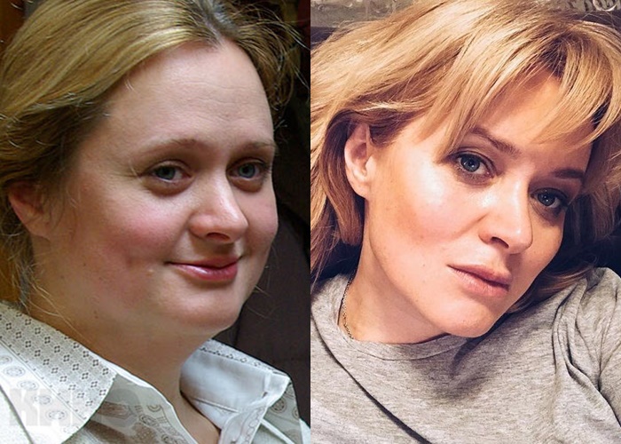 Жиру нет (а щеки долой): лица российских звёзд после похудения - Анна Михалкова