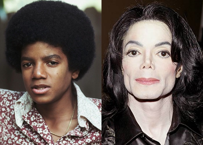 Возраст, ракурс или ринопластика: 10 звёзд-мужчин, чьи носы изменились - Майкл Джексон