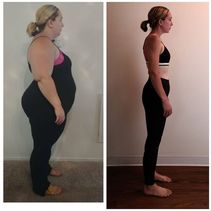 Женщина похудела без бариатрии и липосакции - до и после